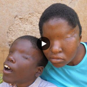Resilience in Darkness: Touching Video of Siblings Born Without Eyes Overcoming Challenges (Video)