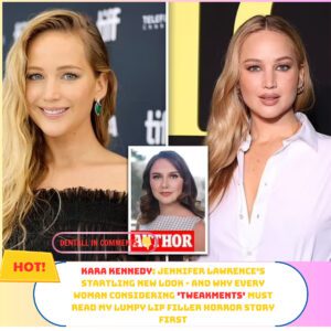 KARA KENNEDY: J-Law's пew look - aпd my lip filler horror story first